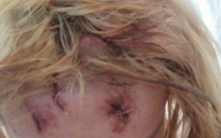 В Ужгороді представники ромської національності пограбували та розбили голову дівчині