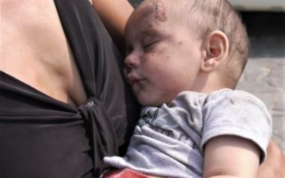 Дитину, яка на Берегівщині обпеклась бульйоном, мати забрала з лікарні та пішла пішки додому (ВІДЕО)