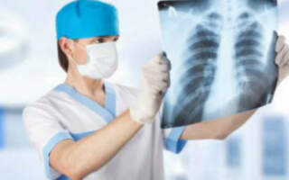 На Закарпатті кількість хворих на туберкульоз зросла на 14 відсотків