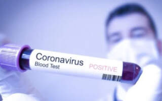 За 10 км від словацького пункту пропуску Малі Селменці на  кордоні із Україною виявили коронавірус.