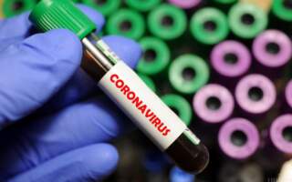 26 нових випадків коронавірусної інфекції на Закарпатті