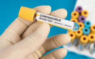 Тестів на коронавірус в Ужгороді нема. В Мукачеві їх 400, наразі там використали 11 із них