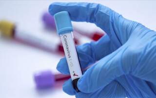 12 нових випадків коронавіруса в Мукачеві