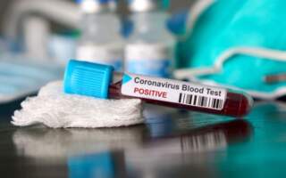У Мукачеві за минулу добу підтверджено 9 випадків коронавірусу