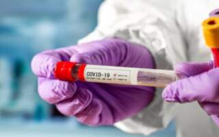 Стан захворюваності на COVID-19 в Мукачеві станом на 19 червня