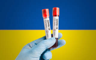 Коронавірус: в Україні знову більше 2 тисяч заражень та 35 летальних випадків, на Закарпатті – 71 діагностований випадок