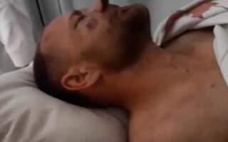 Відео: у мережі показали жахливий стан Віталія Химинця після побиття
