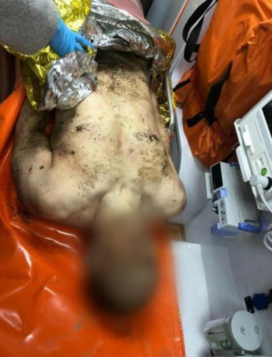 Поблизу смт. Середнє, що на Ужгородщині, знайшли тіло роздягненого мертвого чоловіка, ЗМІ (ФОТО 18+)