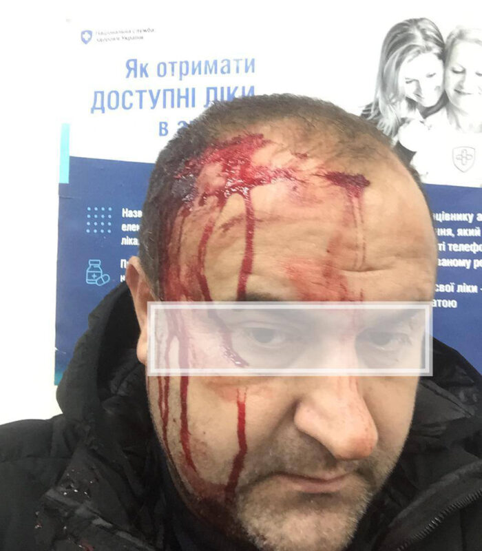 На Закарпатті жорстоко побили журналіста (ФОТО)